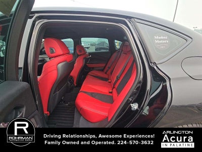 2025 Acura TLX Type S