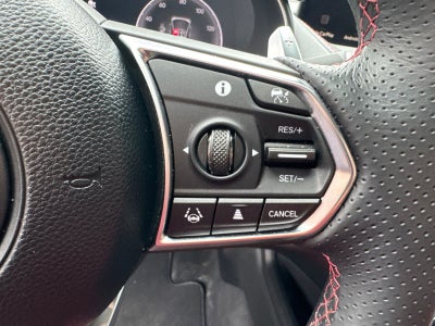 2025 Acura TLX Type S